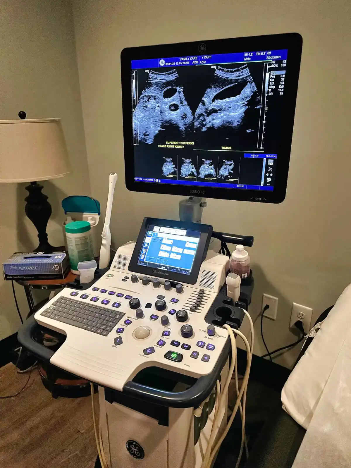 Echografie console